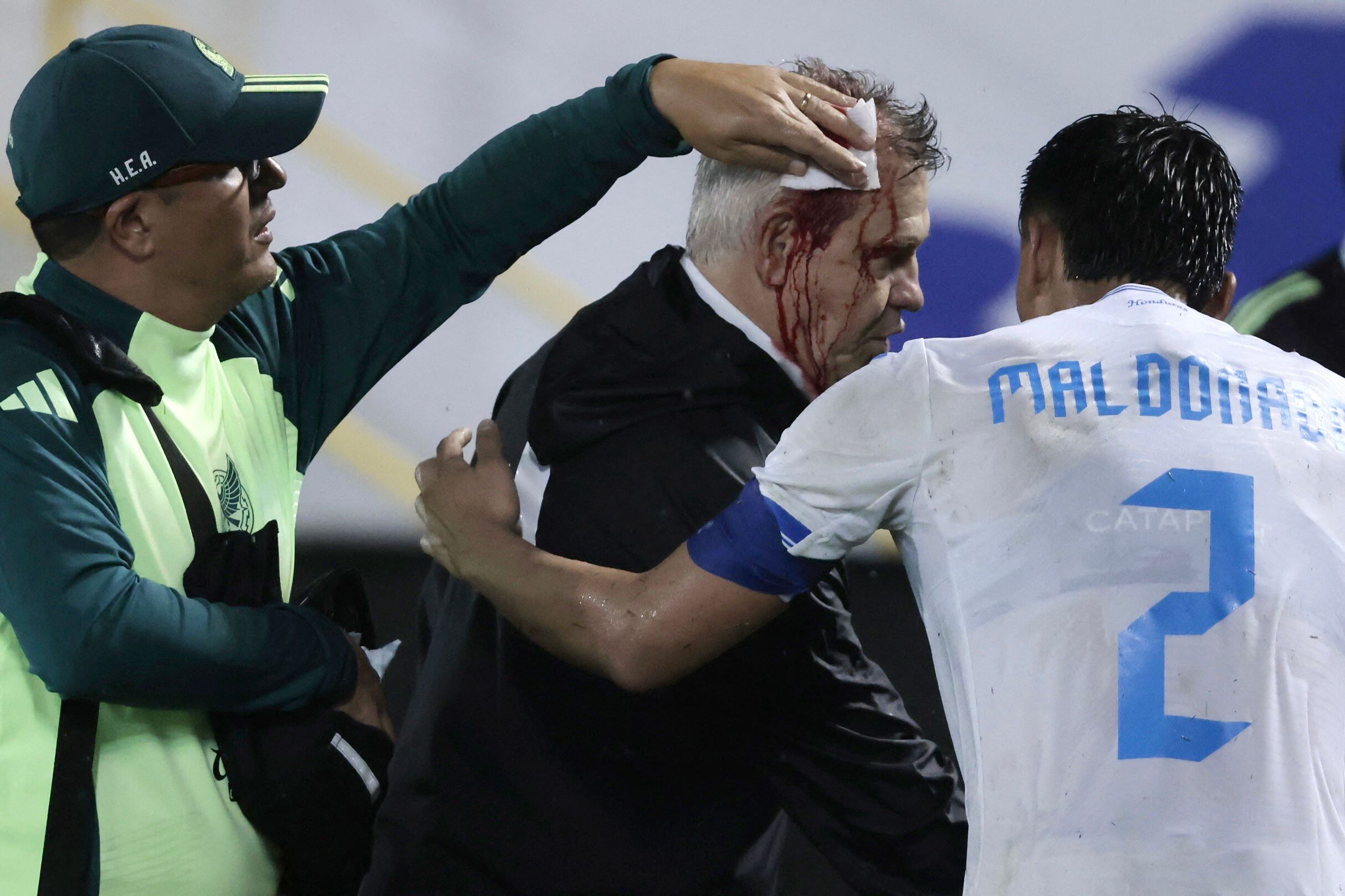 El capitán de la selección de Honduras, Denil Maldonado, acompaña al técnico mexicano, Javier Aguirre, ensangrentado tras la agresión del público